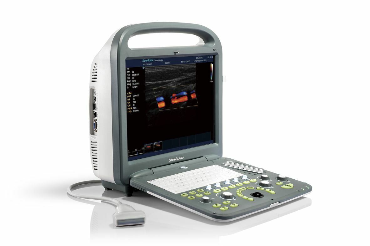 SonoScape S2 with one Linear array Probe L741 5.0-10.0 Mhz DIAGNOSTIC ULTRASOUND MACHINES FOR SALE