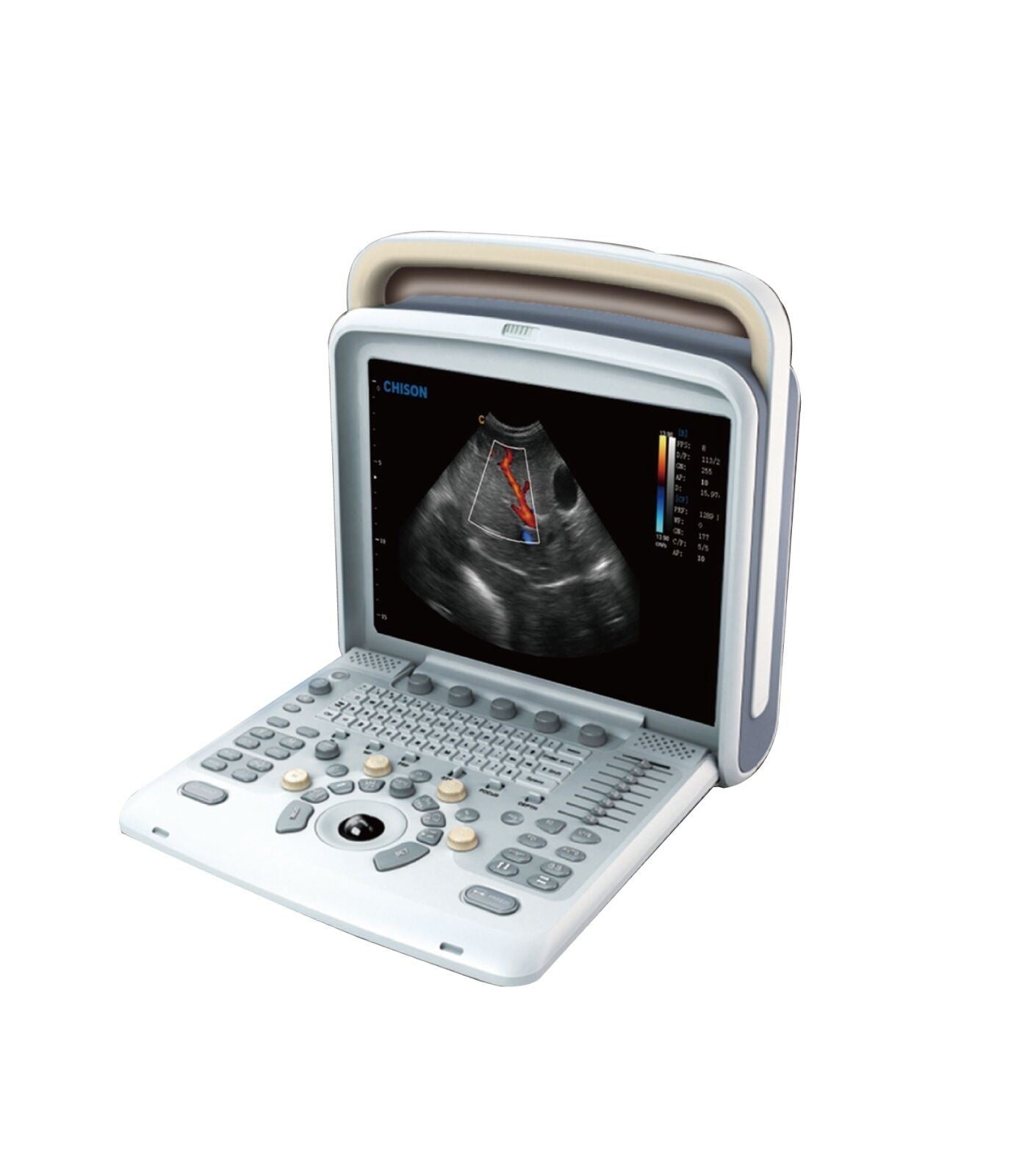 Veterinary Ultrasound Scanner with one Probes - Color Doppler Chison Q5Vet DIAGNOSTIC ULTRASOUND MACHINES FOR SALE