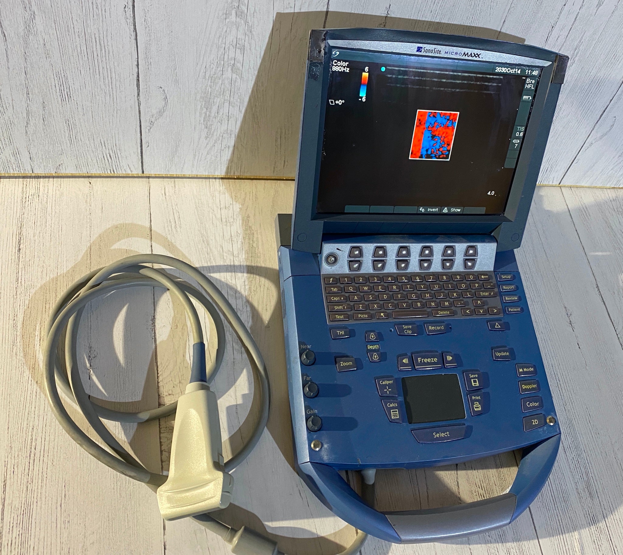 Sonosite MicroMaxx Portable ultrasound with linear array probe HF38 DIAGNOSTIC ULTRASOUND MACHINES FOR SALE