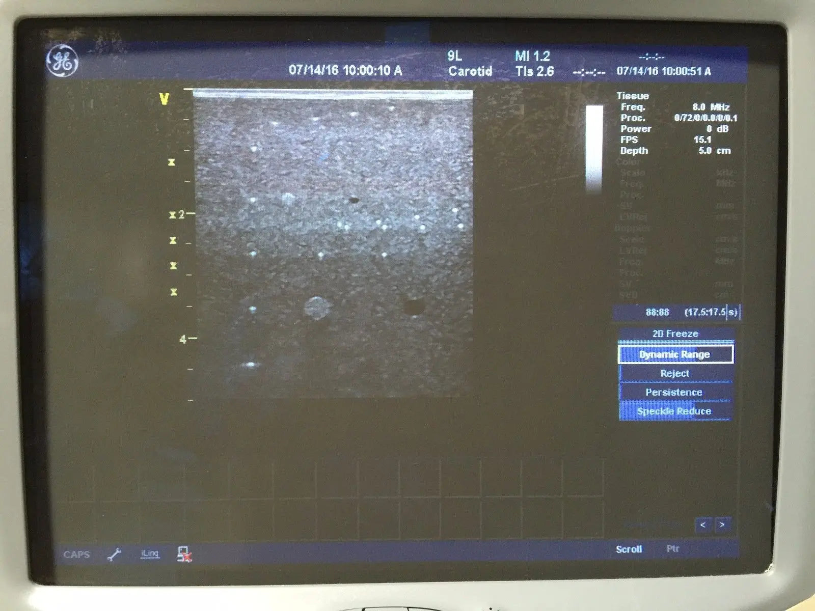 GE 9L Ultrasound Transducer for GE Logiq 9 Systems DIAGNOSTIC ULTRASOUND MACHINES FOR SALE