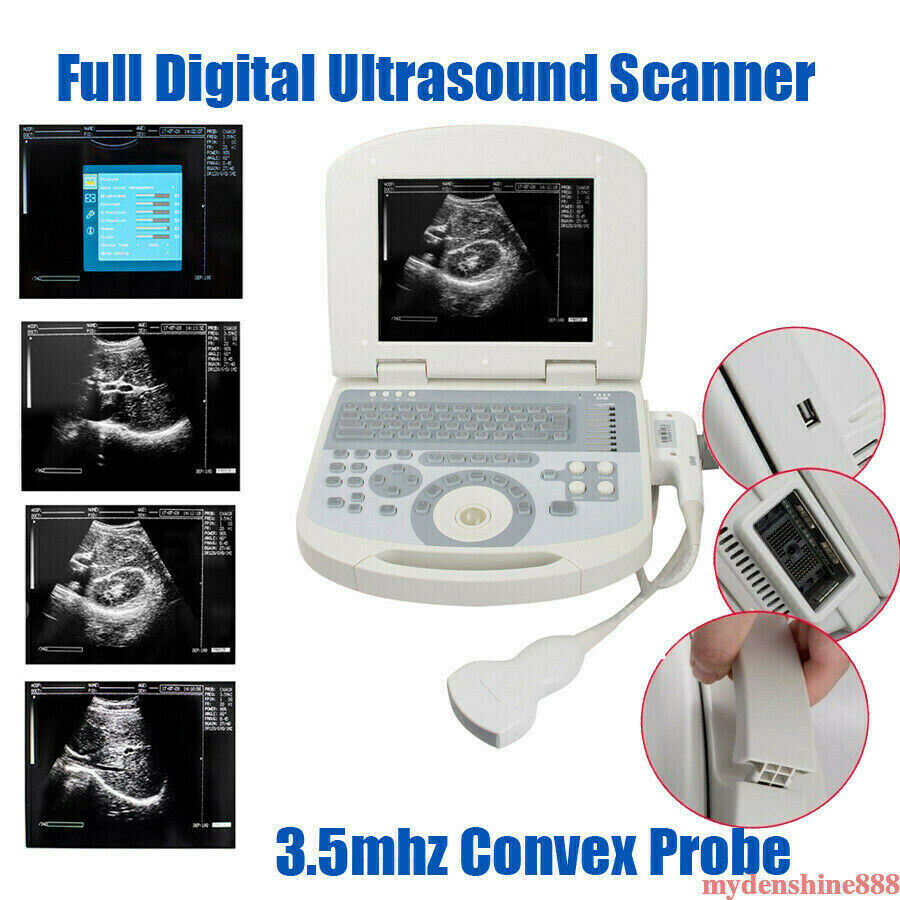 Portable Full 3D Digital Laptop Ultrasound Scanner System Machine + Convex Probe DIAGNOSTIC ULTRASOUND MACHINES FOR SALE