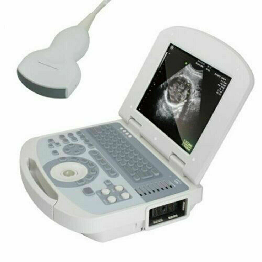 Portable Digital Laptop Medical Ultrasound Scanner Machine+3.5 Convex probe+Gift DIAGNOSTIC ULTRASOUND MACHINES FOR SALE