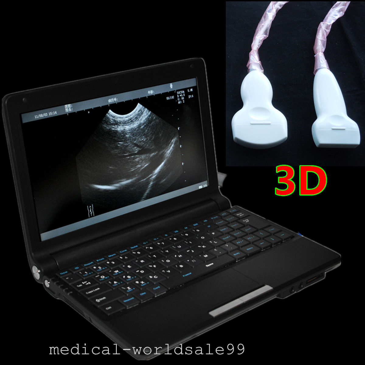 Portable Laptop Digital Ultrasound Scanner Conve/Vignal /Linear 3 Probe 3D Scan DIAGNOSTIC ULTRASOUND MACHINES FOR SALE