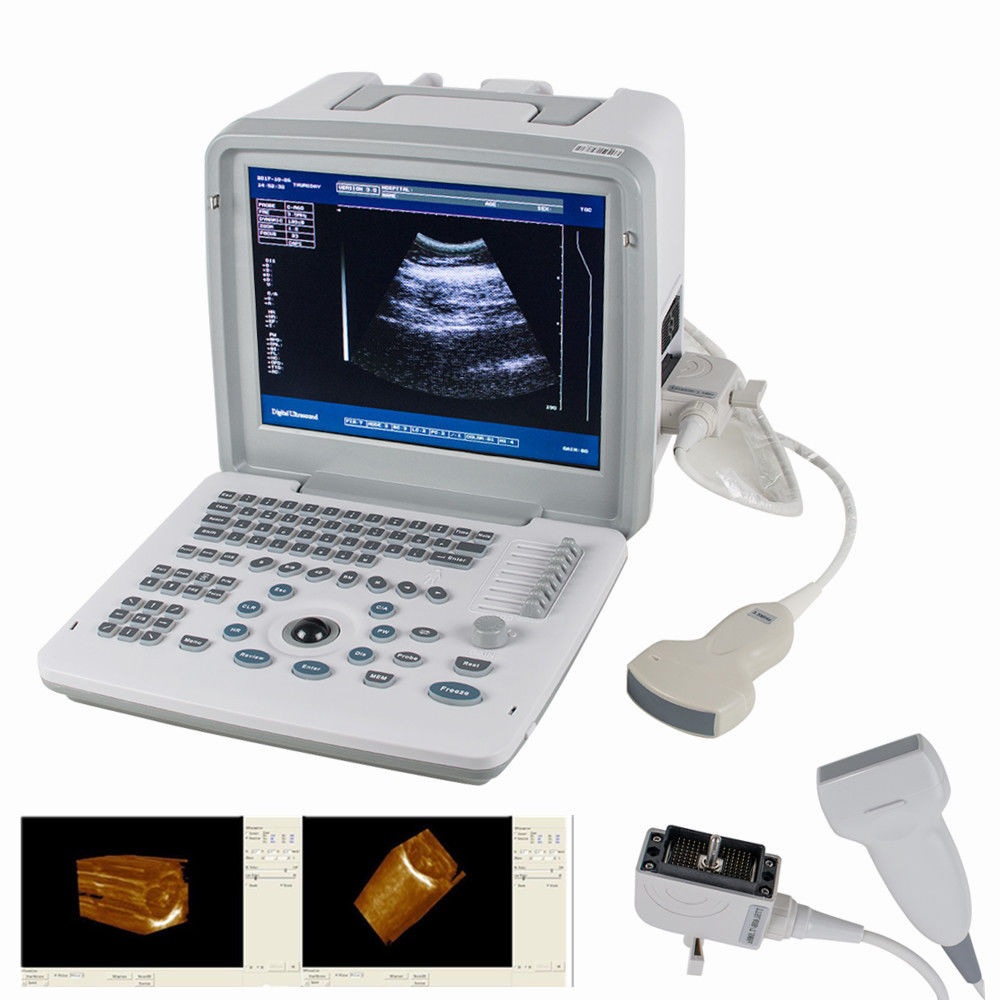 Digital SVGA 3D Portable Ultrasound Scanner Machine Convex Linear 2 Probes MED 190891598837 DIAGNOSTIC ULTRASOUND MACHINES FOR SALE