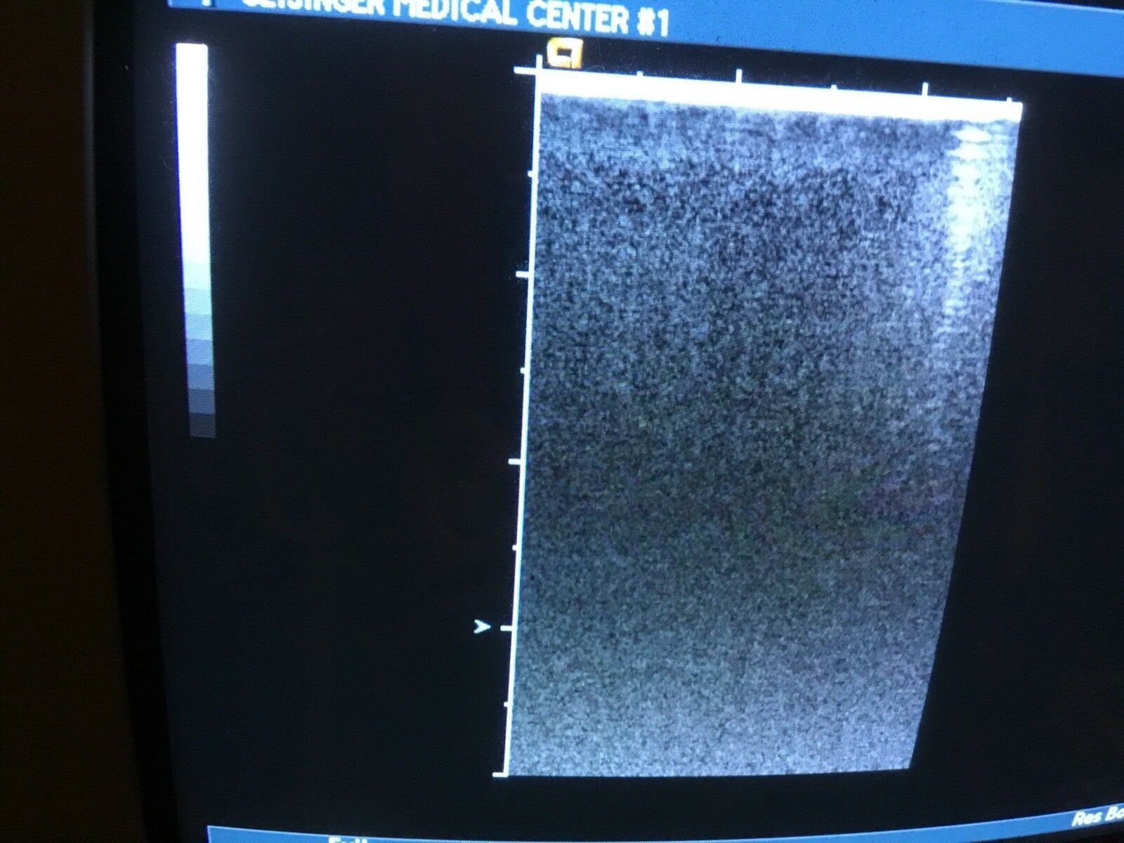 SIEMENS ACUSON 15L8w Ultrasound Transducer Probe DIAGNOSTIC ULTRASOUND MACHINES FOR SALE