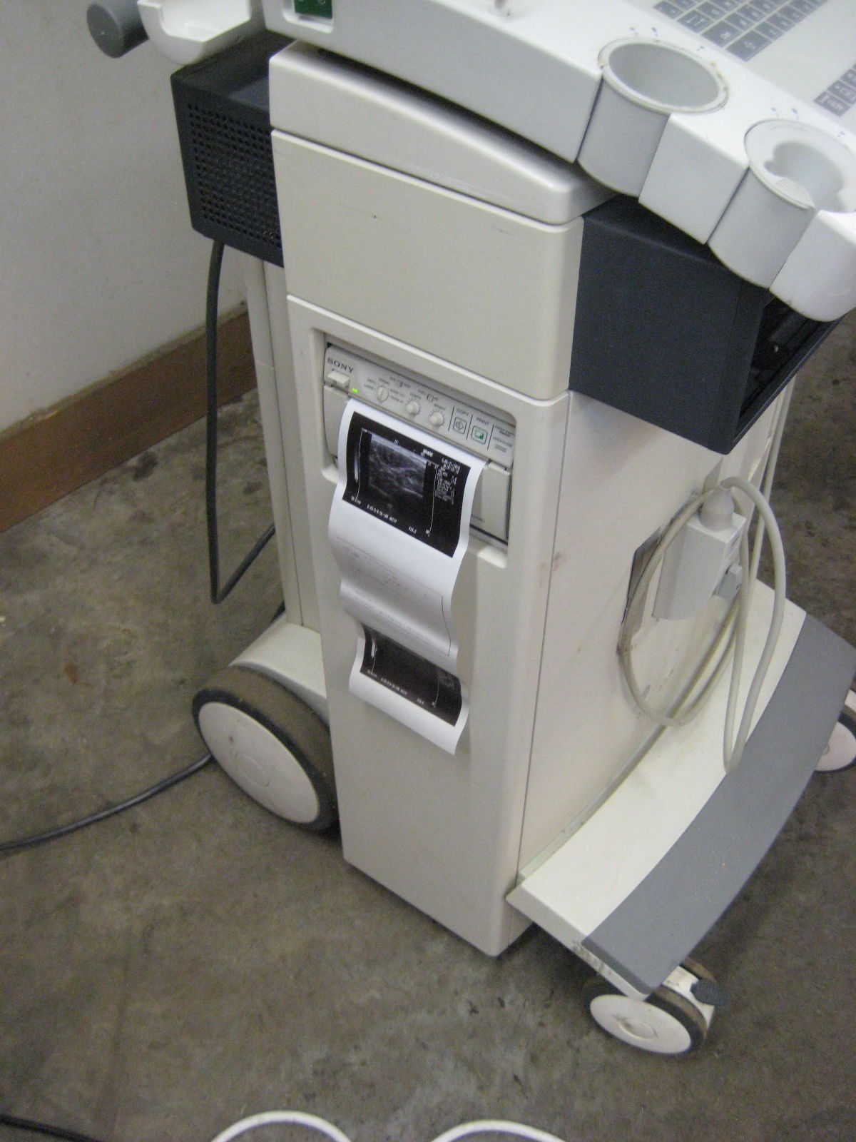 Siemens Sonoline Prima Ultrasound with Linear probe and printer. Guaranteed DIAGNOSTIC ULTRASOUND MACHINES FOR SALE