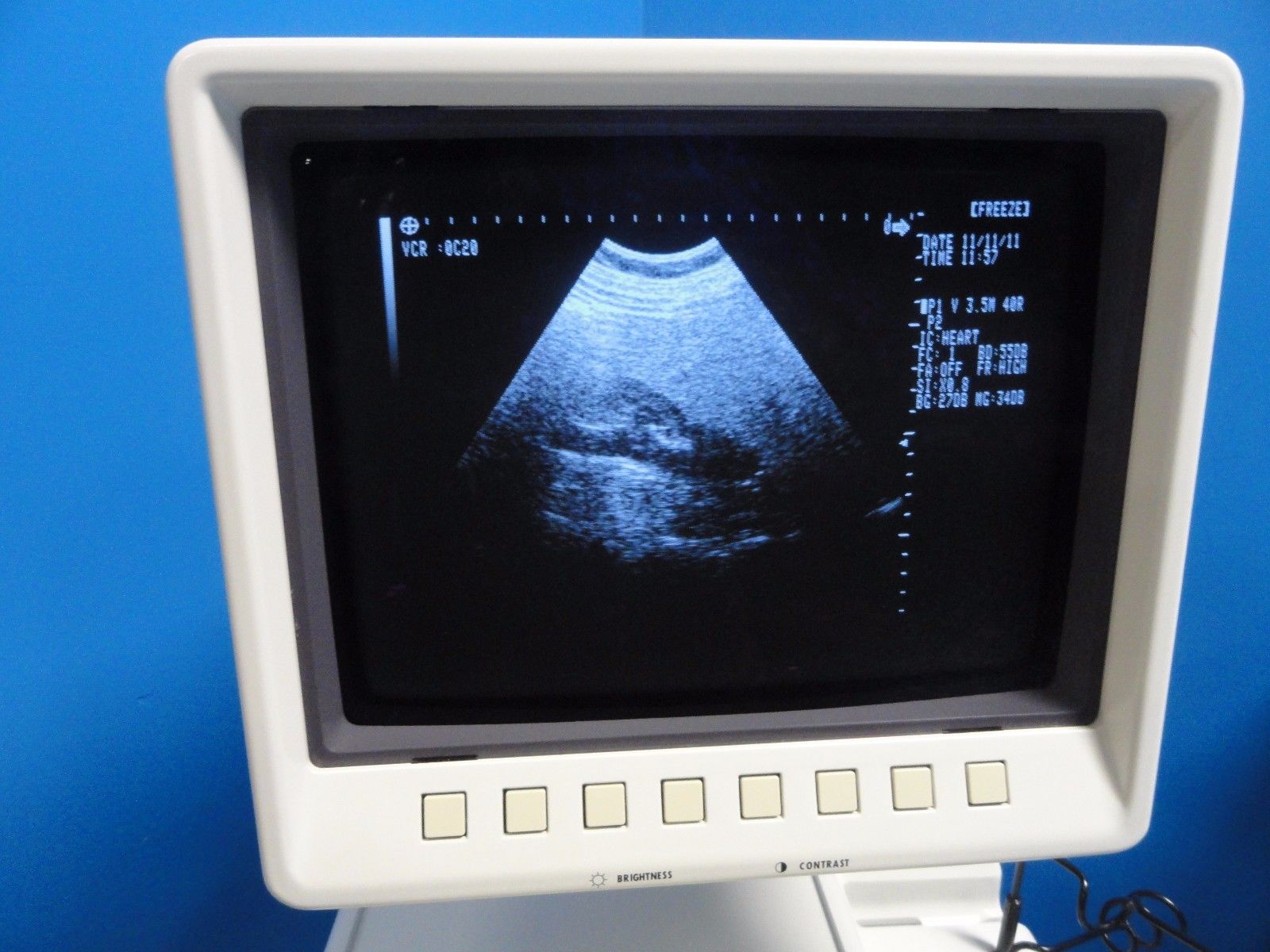 Shimadzu VA40R-035U 3.5 MHz 40mm Convex Probe for SDU-1100 SDU-400 SDU-450~13538 DIAGNOSTIC ULTRASOUND MACHINES FOR SALE