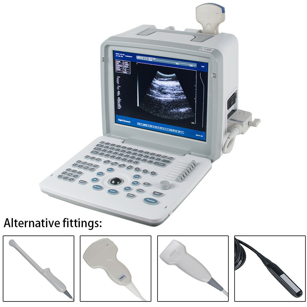 Sonography Digital Portable Ultrasound Scanner Machine with Convex Probe Free 3D 190891344144 DIAGNOSTIC ULTRASOUND MACHINES FOR SALE