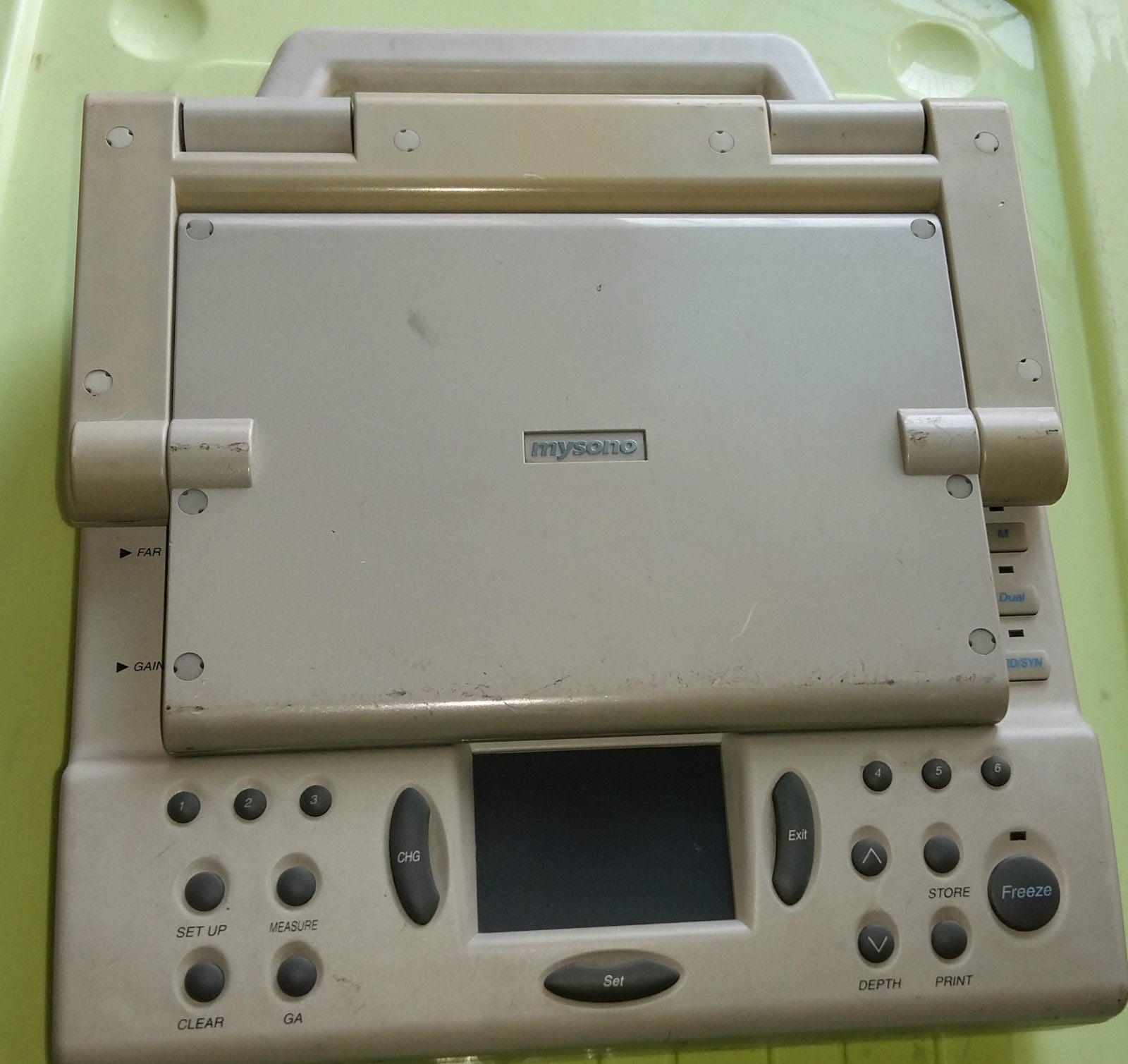 Medison / Samsung mysono 201 personal digital ultrasound / Parts DIAGNOSTIC ULTRASOUND MACHINES FOR SALE