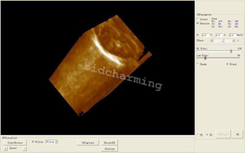 DHL Portable Ultrasound Scanner Convex + transvaginal + Linear probe +3D Version 190891736079 DIAGNOSTIC ULTRASOUND MACHINES FOR SALE