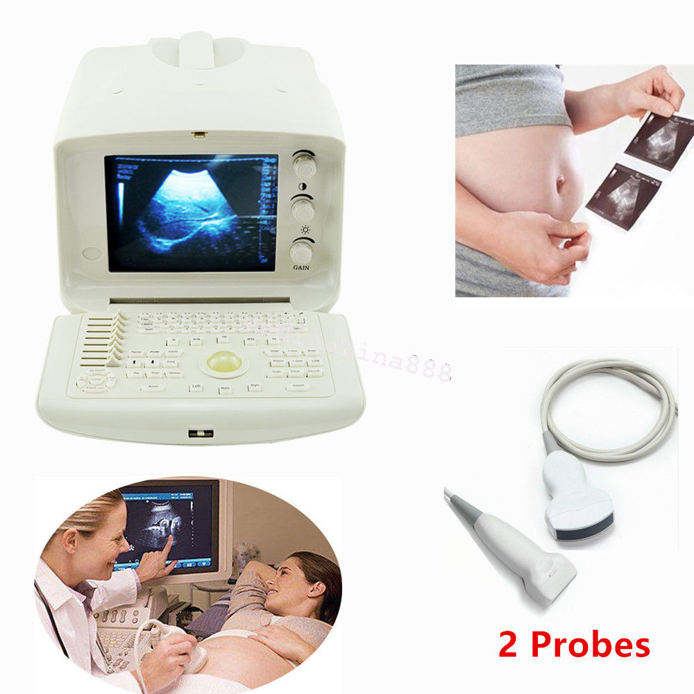 Portable Ultrasound Scanner Machine With convex N Linear Probe N 3D Image CE 190891263667 DIAGNOSTIC ULTRASOUND MACHINES FOR SALE