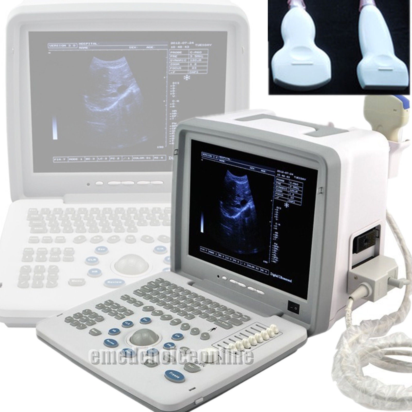Medical 3D Digital Portable Ultrasound Scanner 3.5M Convex + 7.5M Linear 2 Probe DIAGNOSTIC ULTRASOUND MACHINES FOR SALE