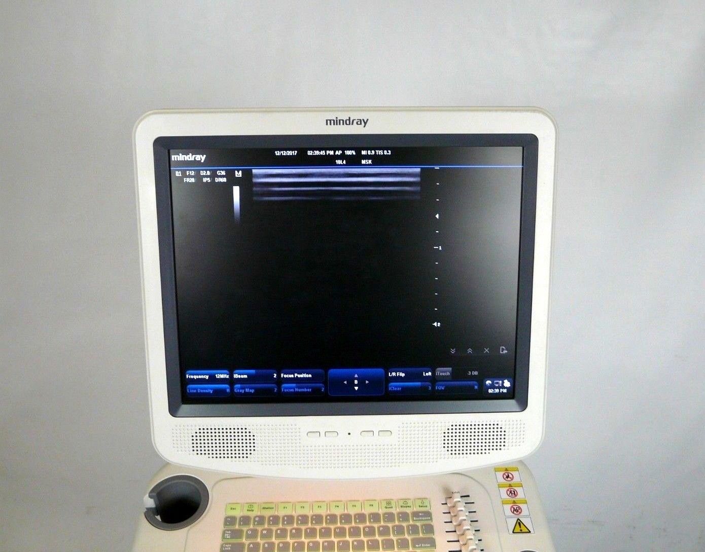 Mindray DC-3 Ultrasound Machine w/ 10L4 Transducer & Sony UP897MD Printer DIAGNOSTIC ULTRASOUND MACHINES FOR SALE