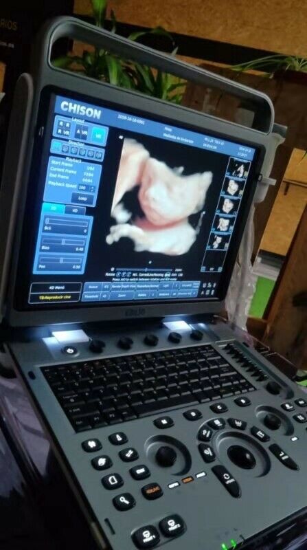 NEW Chison EBit 30 Portable Ultrasound System DIAGNOSTIC ULTRASOUND MACHINES FOR SALE