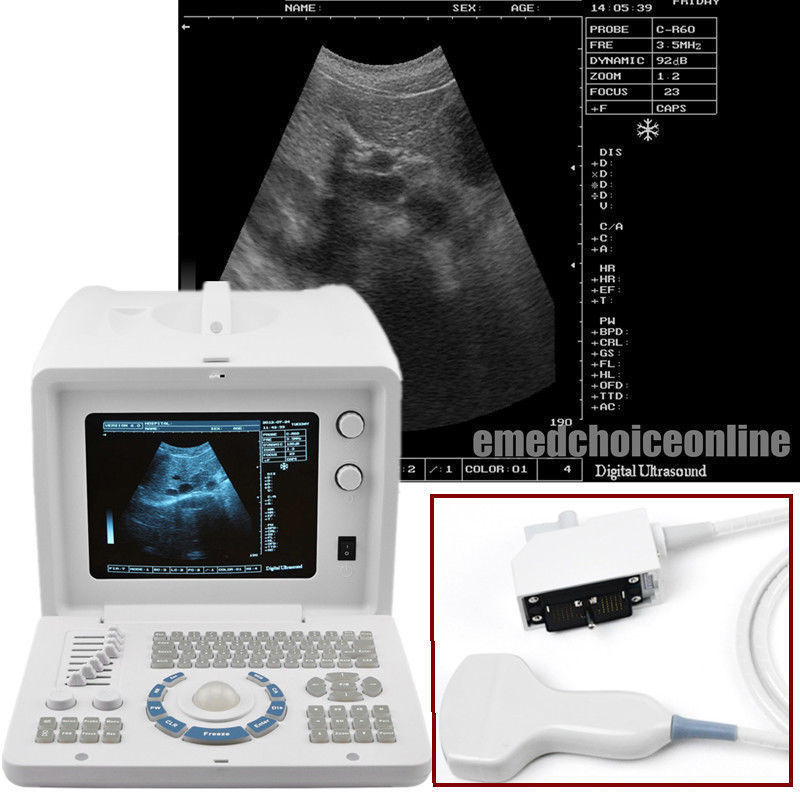 Medical B Ultrasound Ultrasound Scanner Machine + Linear Probe/Sensor + 3D A+ 190891833112 DIAGNOSTIC ULTRASOUND MACHINES FOR SALE