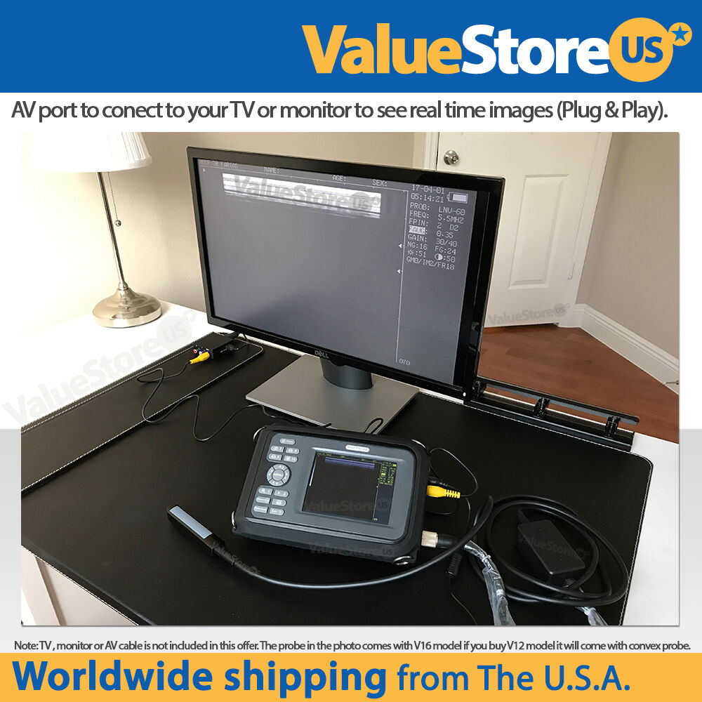 Portable Ultrasound Scanner V16 with 3.5 MHz Convex & 7.5 MHz Rectal Probe DIAGNOSTIC ULTRASOUND MACHINES FOR SALE