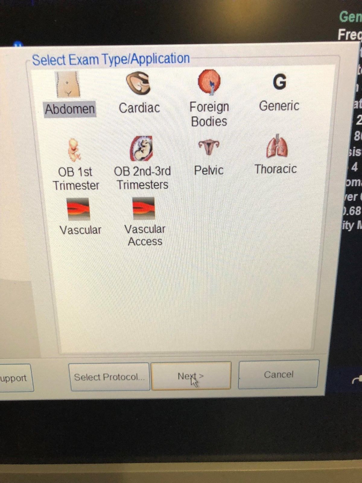 ULTRASONIX SONIXTOUCH OB / GYN - VASCULAR ULTRASOUND SYSTEM DIAGNOSTIC ULTRASOUND MACHINES FOR SALE