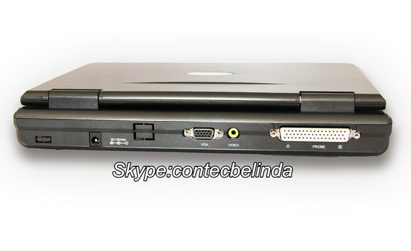 Portable Laptop Digital Ultrasound Scanner High Resolution,Convex/abdominal Prob DIAGNOSTIC ULTRASOUND MACHINES FOR SALE