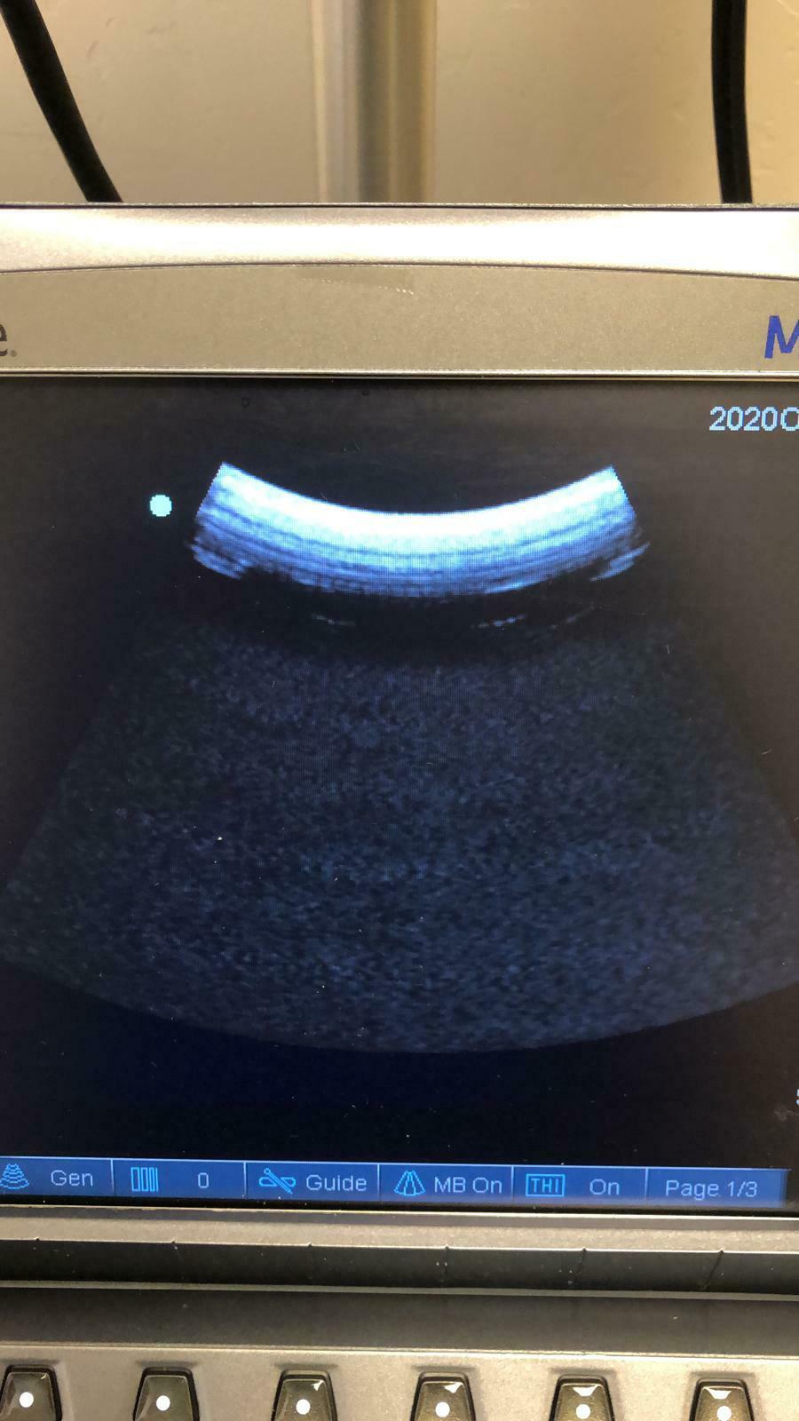 Sonosite C60x Ultrasound Probe for M-Turbo DIAGNOSTIC ULTRASOUND MACHINES FOR SALE