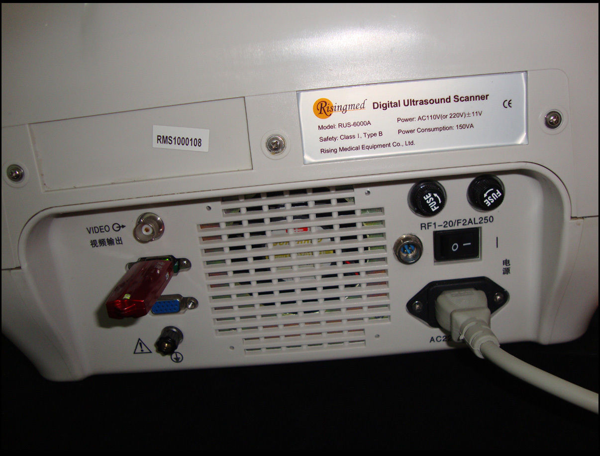 Ultrasonic scanner Portable Ultrasound Scanner Machine Micro-Convex Probe 3D A+ DIAGNOSTIC ULTRASOUND MACHINES FOR SALE