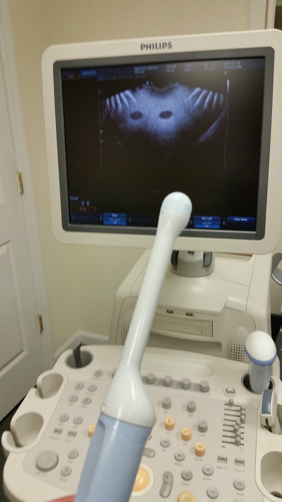 probe head sitting on top of a medical machine