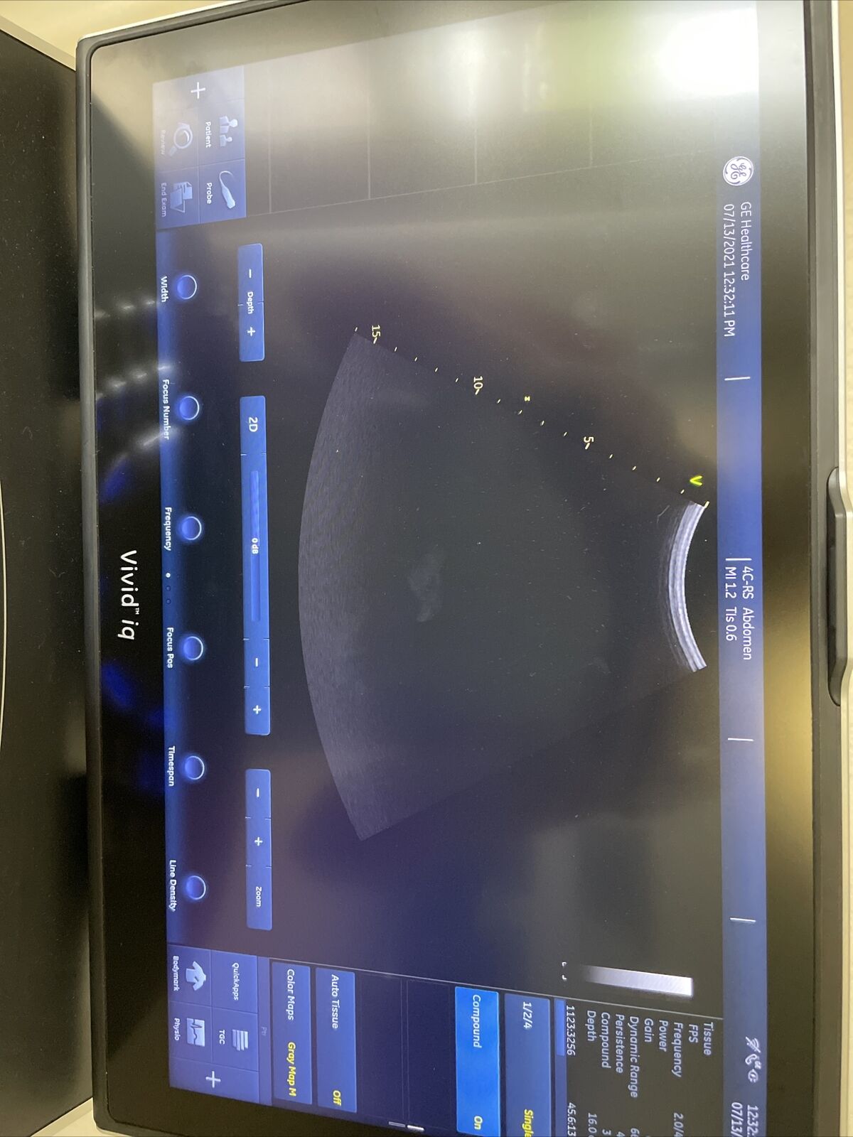 GE 4C-RS Ultrasound Transducer Probe DIAGNOSTIC ULTRASOUND MACHINES FOR SALE