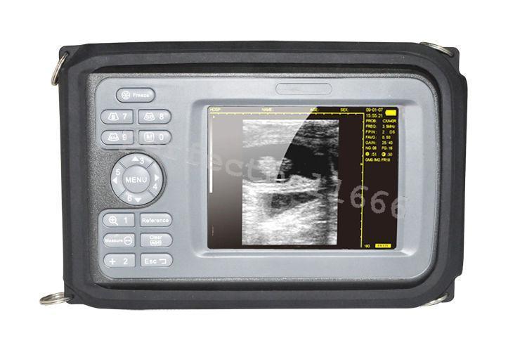 Portable Handheld Digital Ultrasound Scanner Convex Linear With 3 Probes DIAGNOSTIC ULTRASOUND MACHINES FOR SALE