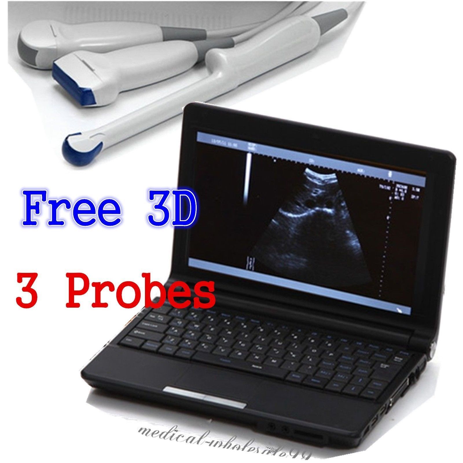 Laptop Ultrasound Scanner/Machine with Convex And Linear and Transvaginal Probe DIAGNOSTIC ULTRASOUND MACHINES FOR SALE