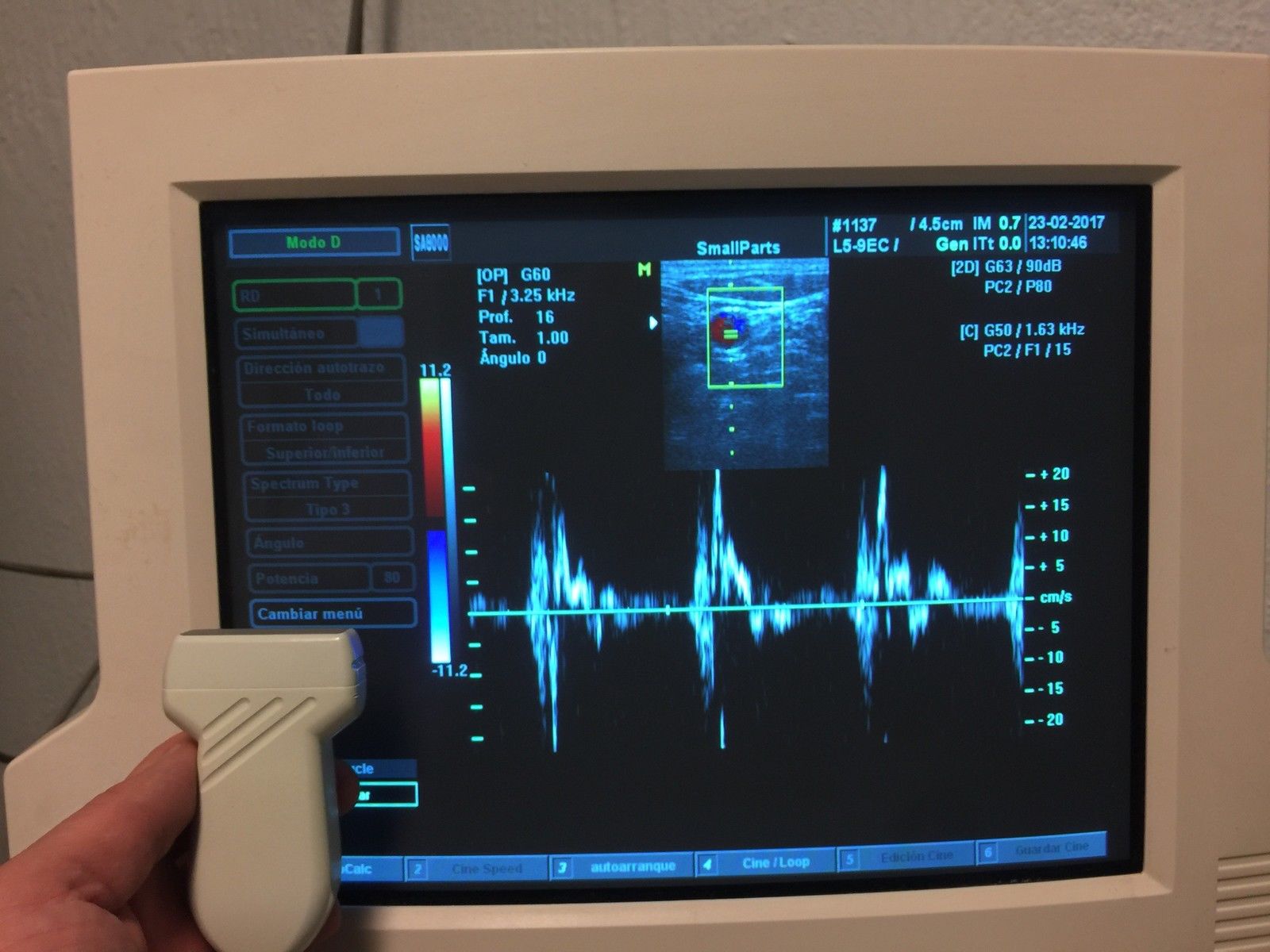 MEDISON L5-9 7.5 MHz Linear Probe FOR SA5500/6000/8800/8000SE/8000EX/8000LV/PICO DIAGNOSTIC ULTRASOUND MACHINES FOR SALE