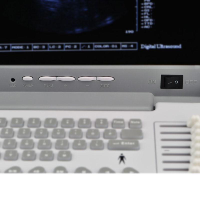CE Full Digital Ultrasound Scanner Machine + Convex and Transvaginal Probe+ 3D 190891951700 DIAGNOSTIC ULTRASOUND MACHINES FOR SALE