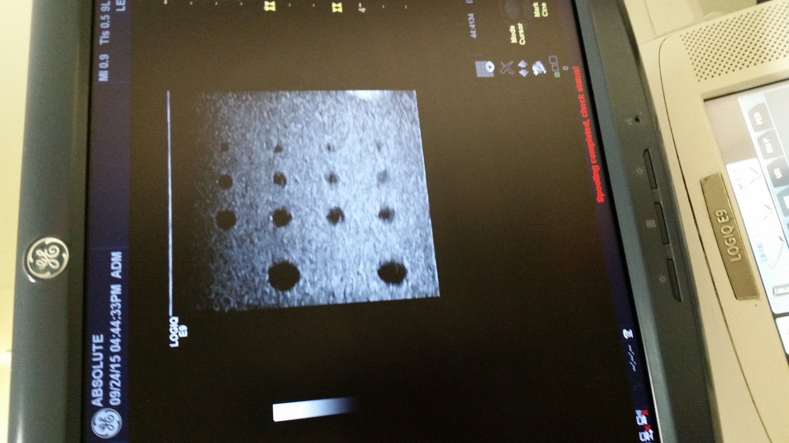 a close up of a ultrasound with a picture on the screen