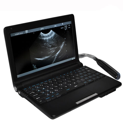 Vet Digital Laptop Veterinary Ultrasound Scanner Machine+ Rectal probe 3D A+ 190891426246 DIAGNOSTIC ULTRASOUND MACHINES FOR SALE