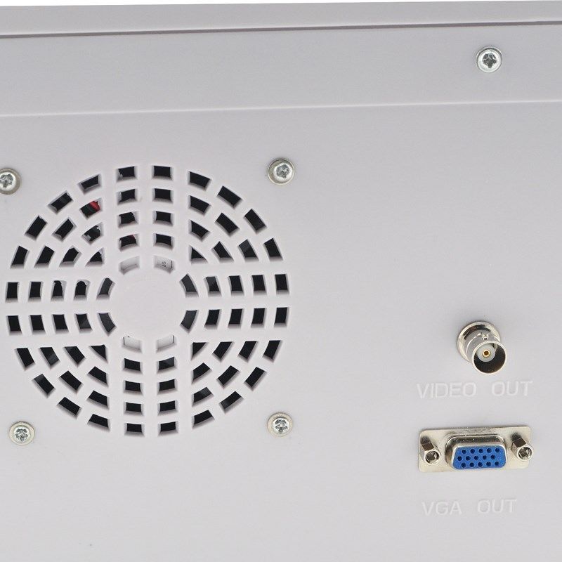 Portable 10.1 Inch Ultrasound Scanner Test Convex Transvaginal Probes USB SVGA DIAGNOSTIC ULTRASOUND MACHINES FOR SALE