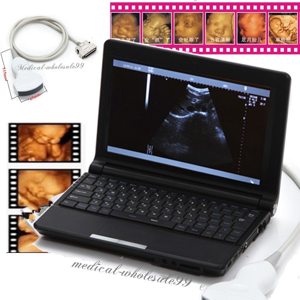 Laptop Ultrasound Scanner/Machine with Convex And Linear and Transvaginal Probe DIAGNOSTIC ULTRASOUND MACHINES FOR SALE