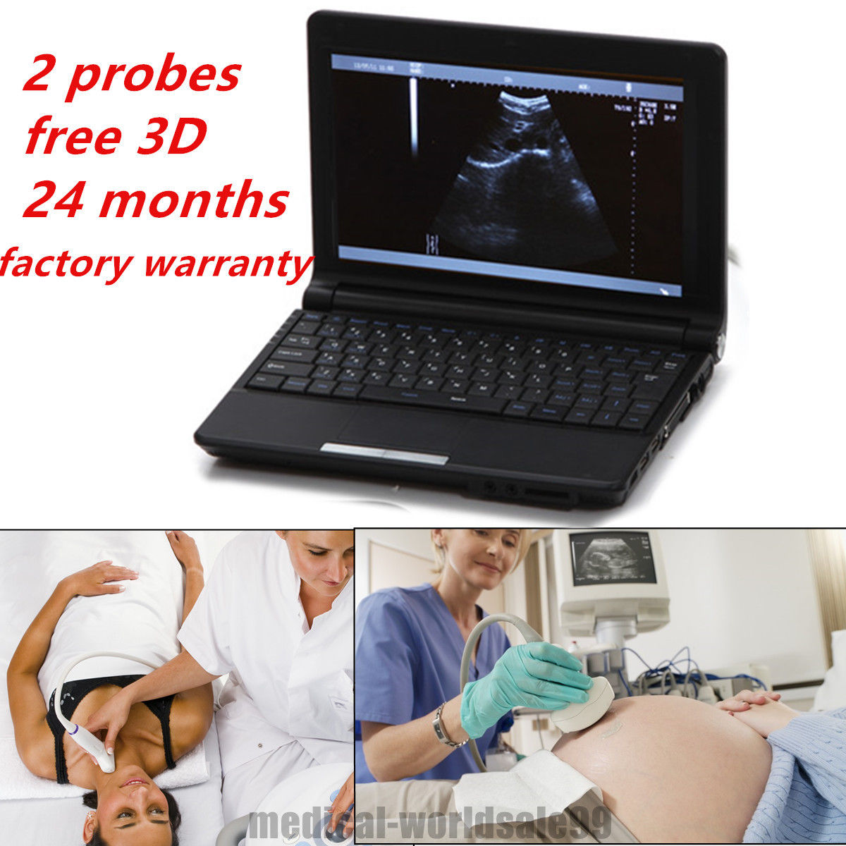 Laptop Digital Ultrasound Scanner Unit Machine Convex + Linear 2 Probes 3D DHL 190891457172 DIAGNOSTIC ULTRASOUND MACHINES FOR SALE
