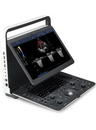SonoScape E2 ultrasound & One linear array probe L741 Color doppler Vascular DIAGNOSTIC ULTRASOUND MACHINES FOR SALE