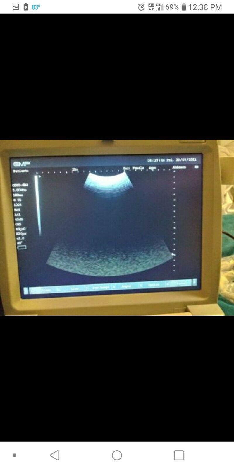 Portable Ultrasound Machine DIAGNOSTIC ULTRASOUND MACHINES FOR SALE