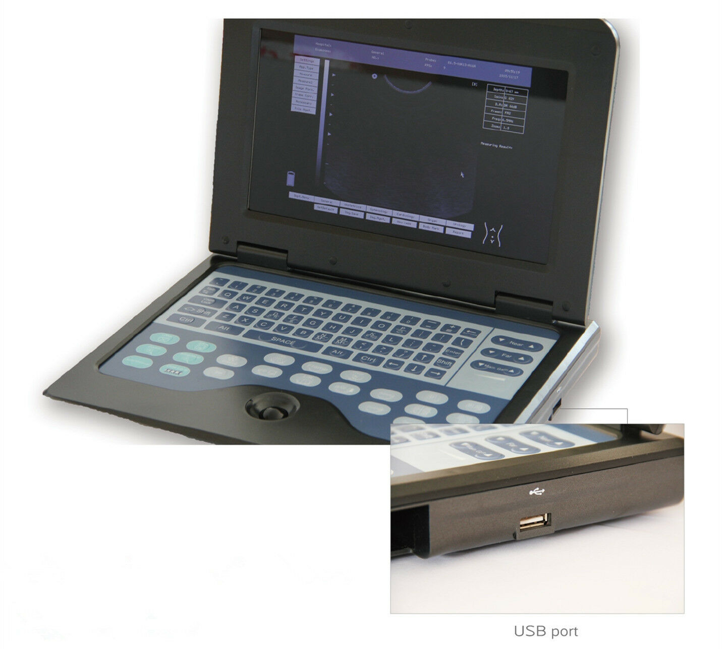 Portable Laptop Digital Ultrasound Scanner 3.5 Convex+ 6.5 Transvaginal 2 probes DIAGNOSTIC ULTRASOUND MACHINES FOR SALE