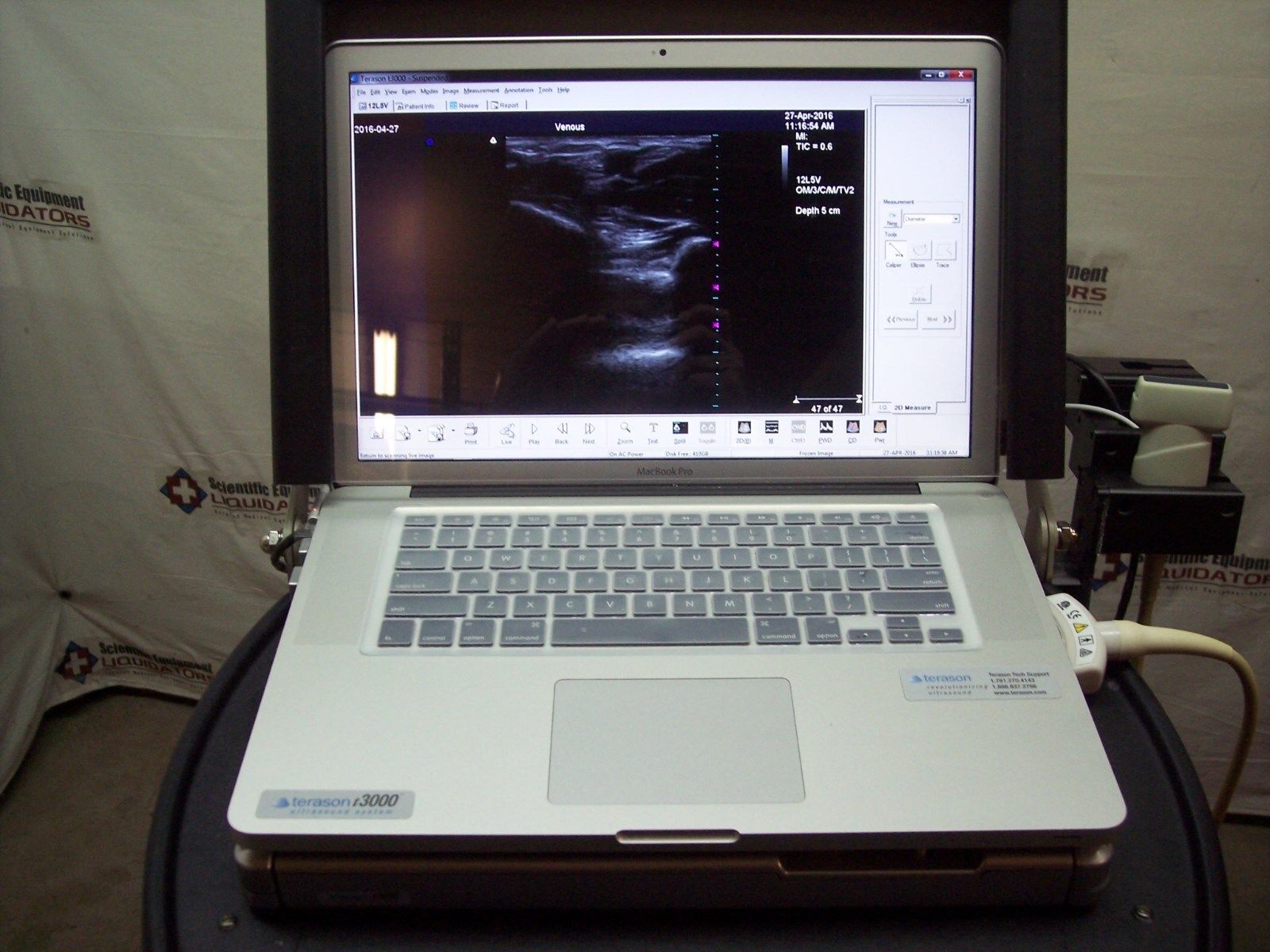 Terason t3000 Ultrasound System DIAGNOSTIC ULTRASOUND MACHINES FOR SALE