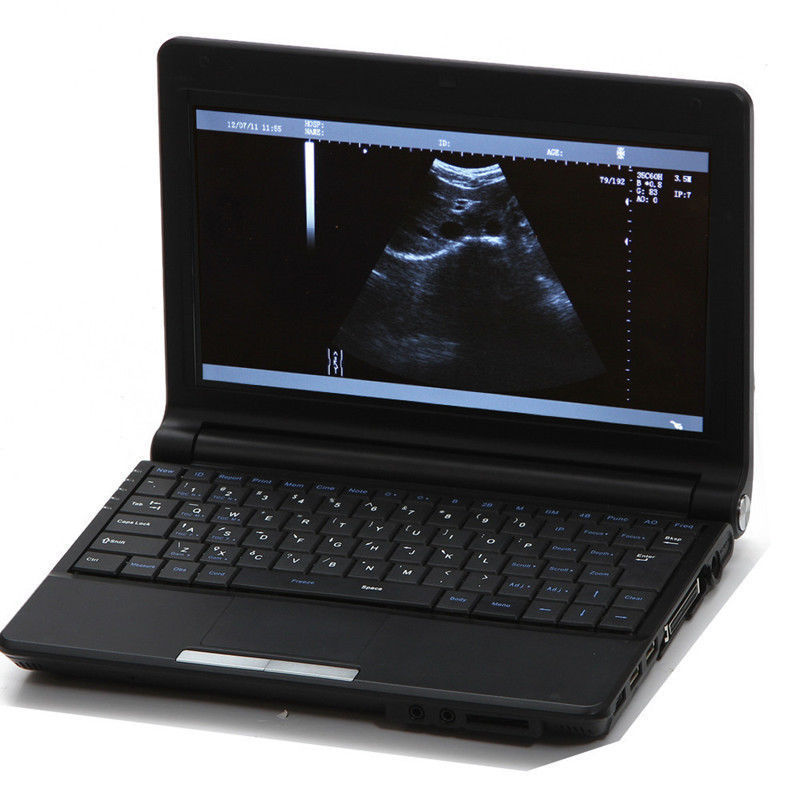 Hot CE Convex+Linear Probe,Digital Portable Laptop Ultrasound Scanner+Free 3D 190891829993 DIAGNOSTIC ULTRASOUND MACHINES FOR SALE