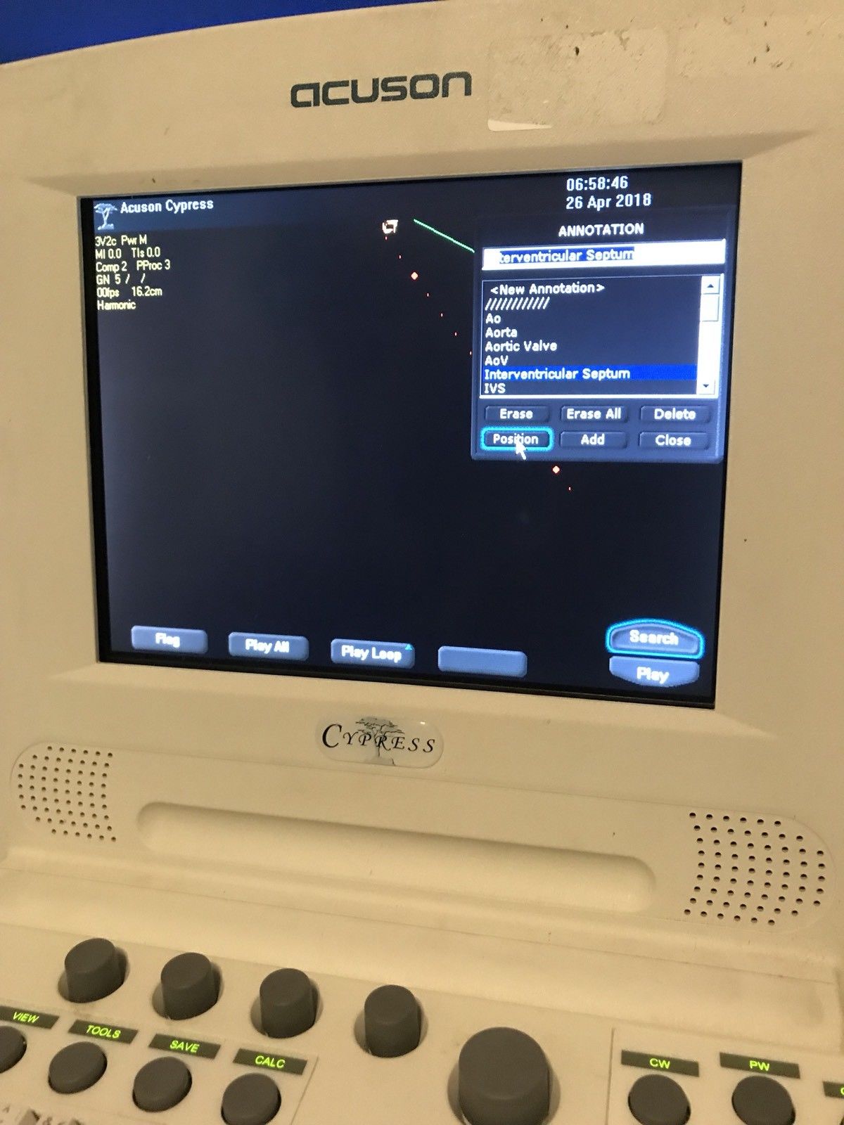 SIEMENS Acuson Cypress Ultrasound Machine DIAGNOSTIC ULTRASOUND MACHINES FOR SALE