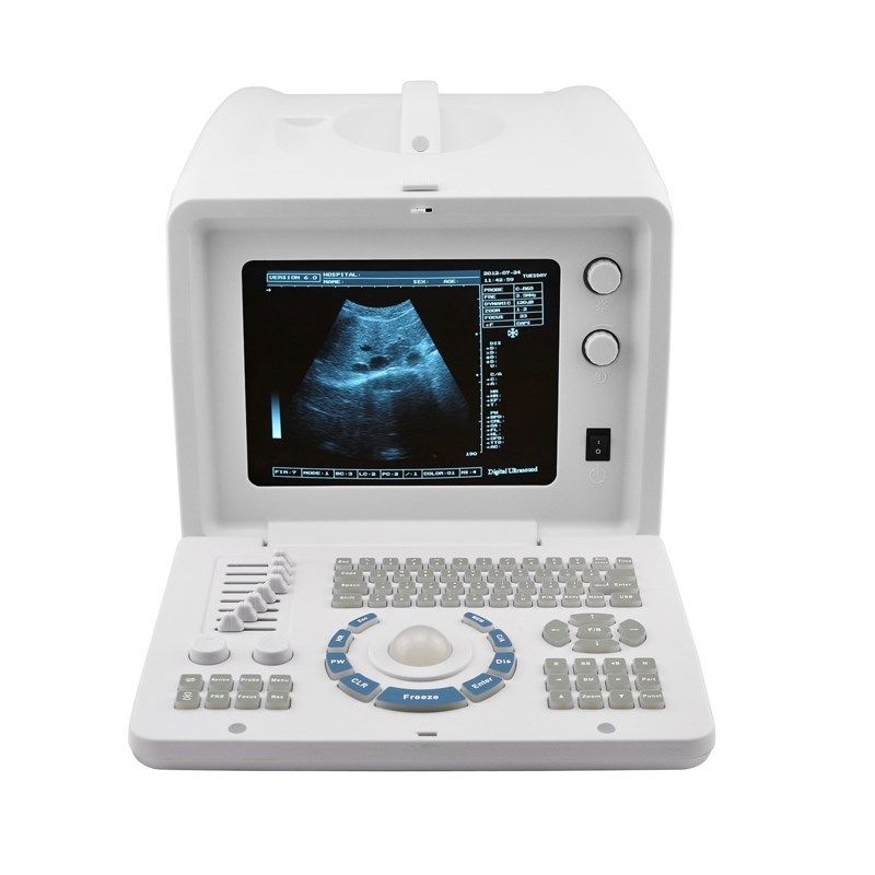 Portable 10.1 Inch Ultrasound Scanner Test Convex Transvaginal Probes USB SVGA DIAGNOSTIC ULTRASOUND MACHINES FOR SALE