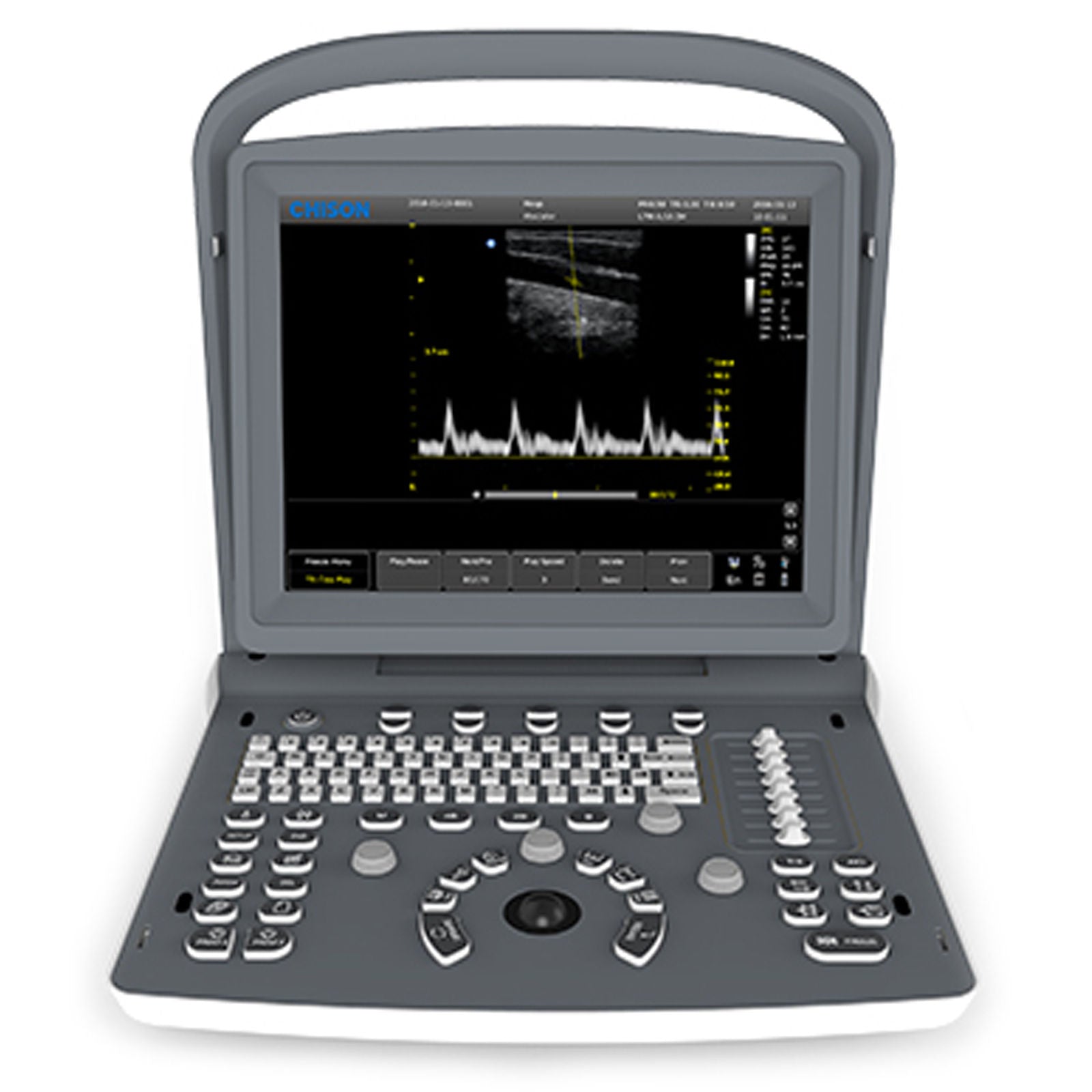 ECO2 Chison Portable Digital Ultrasound Scanner+3.5MHz ConvexProbe+CASE 2016 eee DIAGNOSTIC ULTRASOUND MACHINES FOR SALE