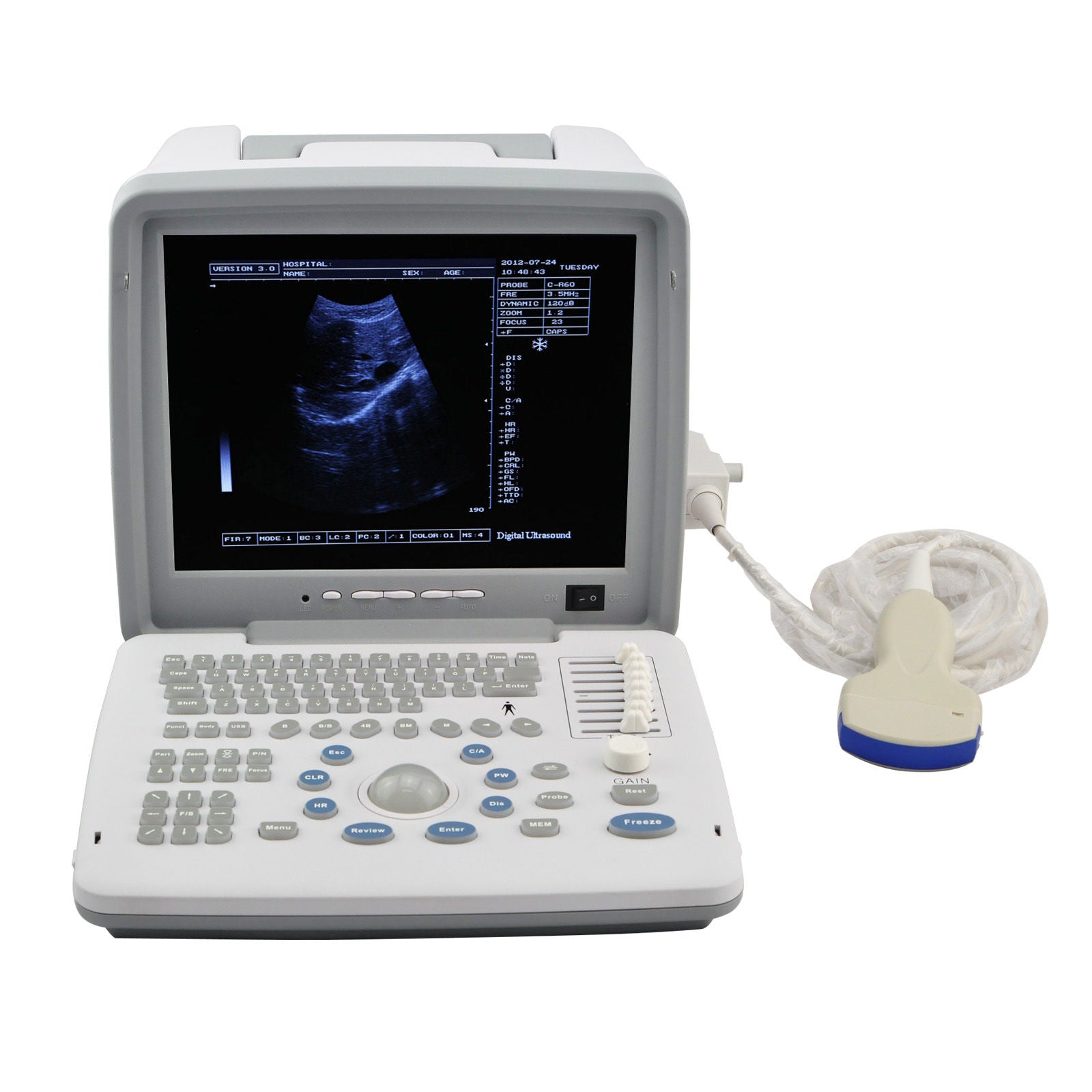 Portable Ultrasound Machine Scanner System Convex Probe+Transvaginal 3D Version 190891055620 DIAGNOSTIC ULTRASOUND MACHINES FOR SALE