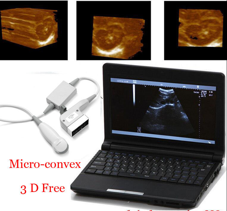 Veterianry Full Digital Laptop Ultrasound Scanner Micro-Convex Probe Battery AA DIAGNOSTIC ULTRASOUND MACHINES FOR SALE