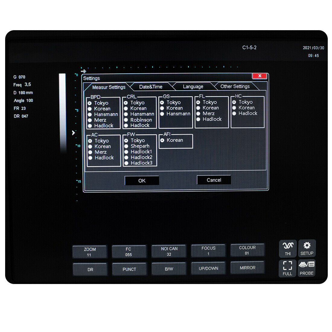 Portable LED Ultrasound Scanner Laptop Machine Ultrasonic Systems +Convex Probe DIAGNOSTIC ULTRASOUND MACHINES FOR SALE