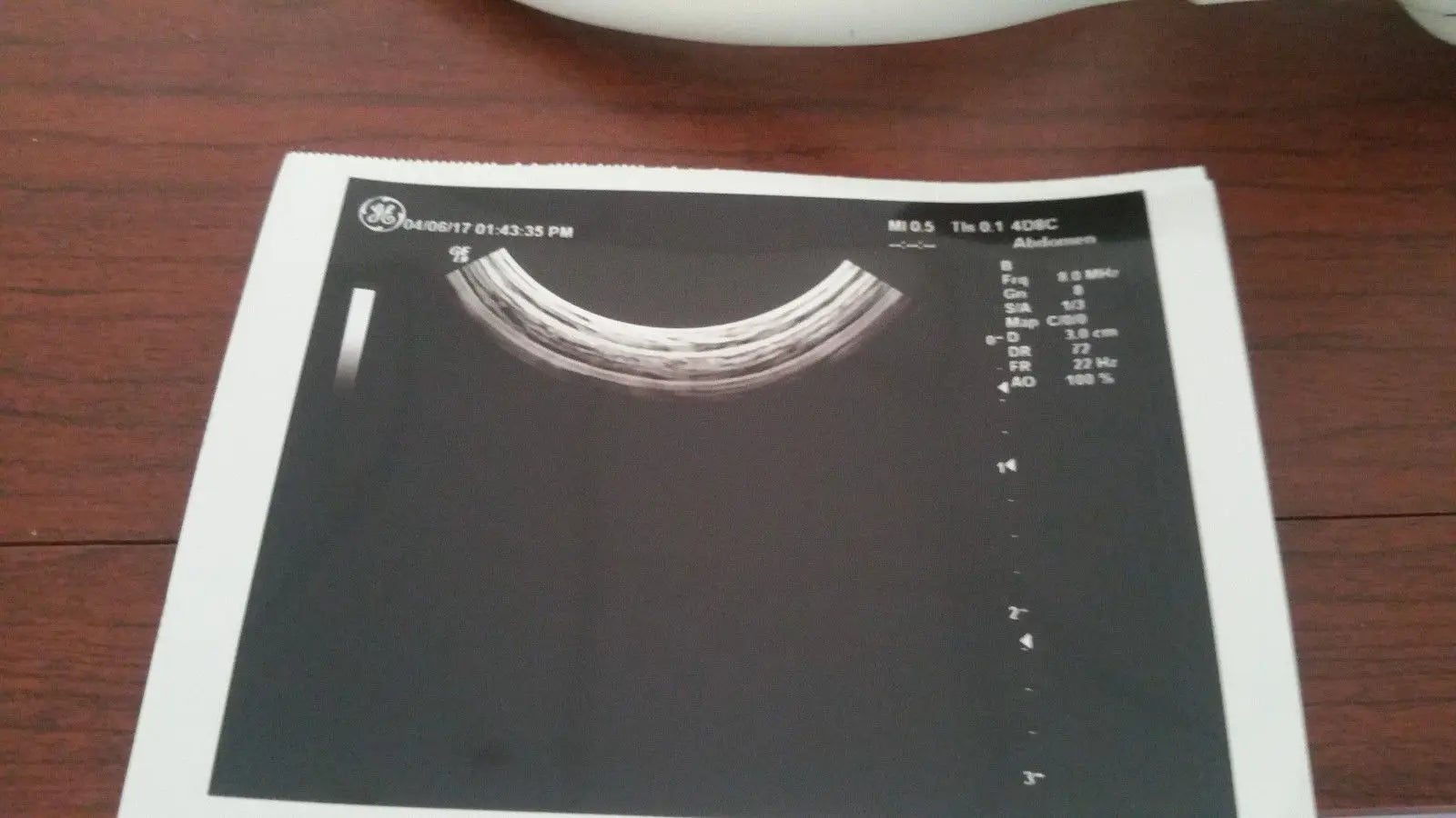 GE 4D8C Convex 4D Ultrasound Transducer Probe DIAGNOSTIC ULTRASOUND MACHINES FOR SALE