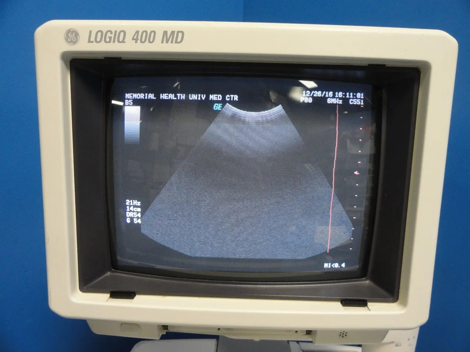 GE Logiq 400 MD Soft Pack Ultrasound W/ C364, C551, 739L Probes & Printer~12413 DIAGNOSTIC ULTRASOUND MACHINES FOR SALE