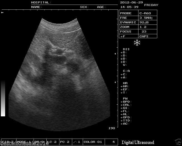 Veterinary B-Ultrasound Scanner/Machine Micro-convex Array Probe VET/Animals 3D 190891949295 DIAGNOSTIC ULTRASOUND MACHINES FOR SALE