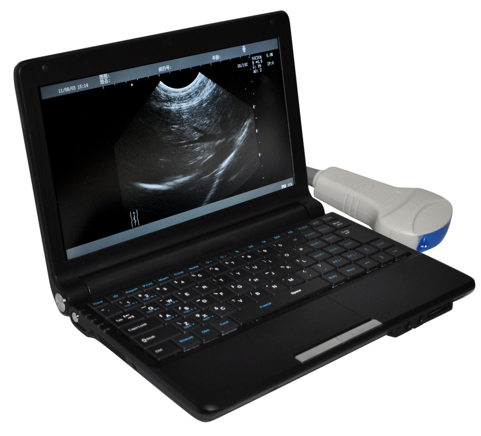 Digital Portable Ultrasound Machine Scanner Convex Probe+ 3D Oximeter 1024 Image DIAGNOSTIC ULTRASOUND MACHINES FOR SALE